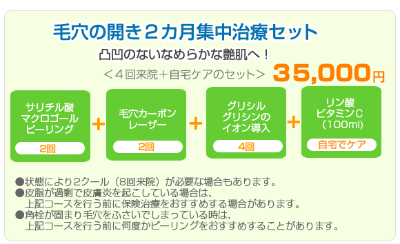 �ь��J�����P�R�[�X38000�~�~
